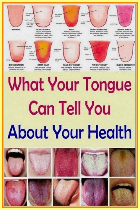 What Does Your Tongue Say About Your Health Artofit