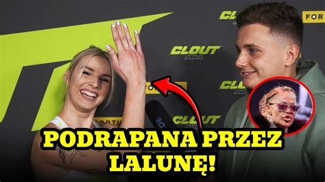 Agnieszka Bobek Pokazuje Rany Po F F Laluna J Podrapa A Youtube