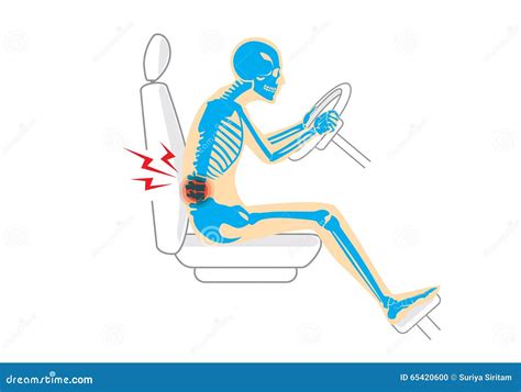 Back Pain Because Wrong Posture In Driving Stock Vector Image