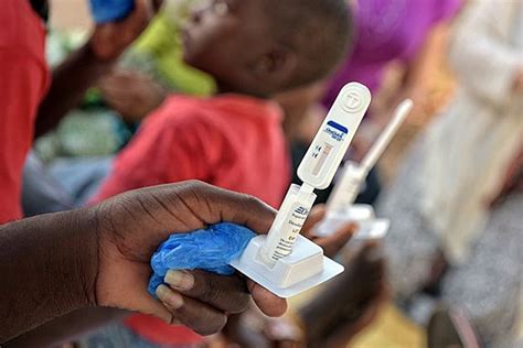 HIV Self Test Kits Use High Among Key Population Ministry Of Health