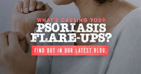 Psoriasis: Triggers That Cause Flare-ups – IC Research Tennessee