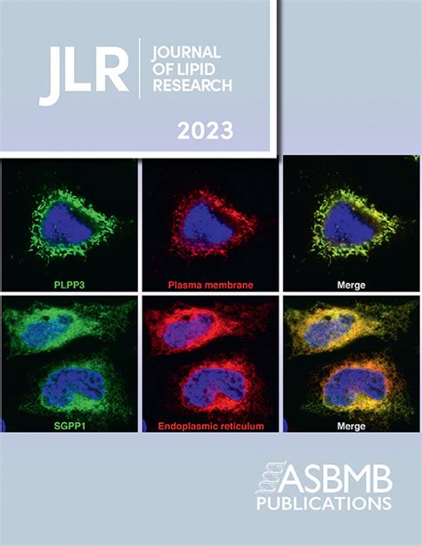 Home Page Journal Of Lipid Research