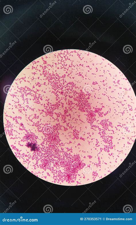 Gram Staining Is A Method Of Differentiating Bacterial Species Into