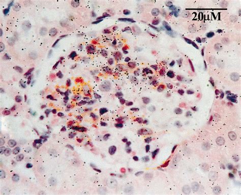 Combined Actin Immunohistochemistry Mesangial Cells And Rptp Gmc1 In Download Scientific