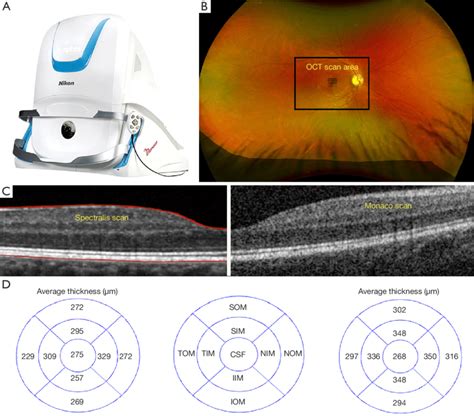 Optos Monaco Fundus Photography And Optical Coherence Tomography Oct