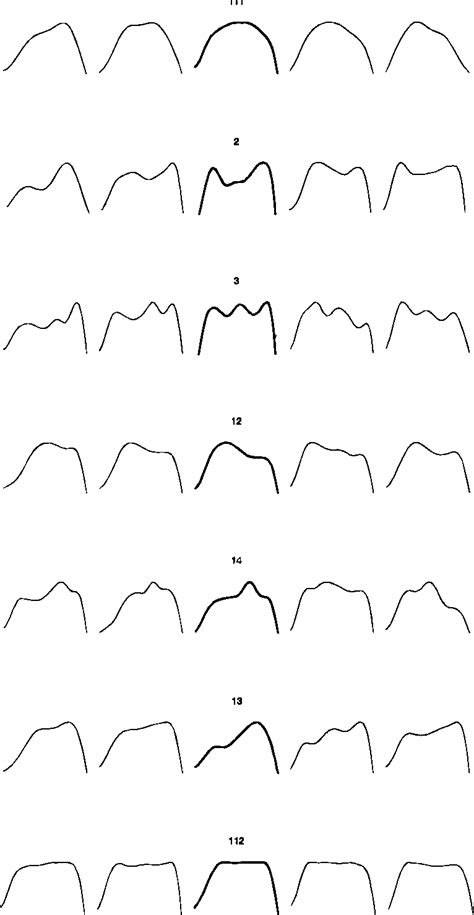 Figure 2 From Classification Of Nasal Inspiratory Flow Shapes By