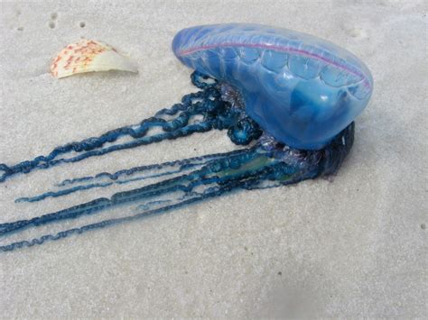 How to Treat a Jellyfish Sting and How to Prevent Them