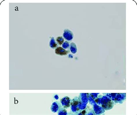 What Is Smear In Cytology