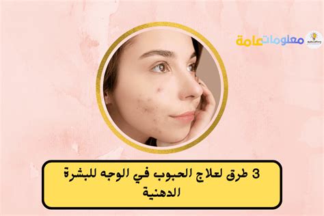 ٣ طرق لعلاج الحبوب في الوجه للبشرة الدهنية