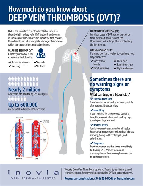 Deep Vein Thrombosis (DVT) Risks - Inovia Vein Specialty Center