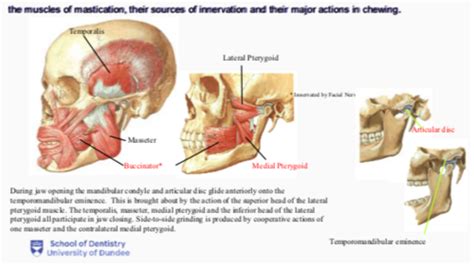 Oral Surgery Tmj Surgery Flashcards Quizlet