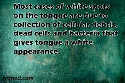 White Spots on Tongue: Couses and Treatment