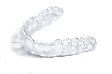 Clear Teeth Aligners for an Elegant smile - toothsi