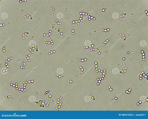 Budding Yeast Cells In Urine