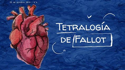 Tetralogía De Fallot Guillermo Monroy uDocz