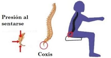 Dolor De Coxis Causas Y Tratamiento Dolor De Espalda Y Cuello