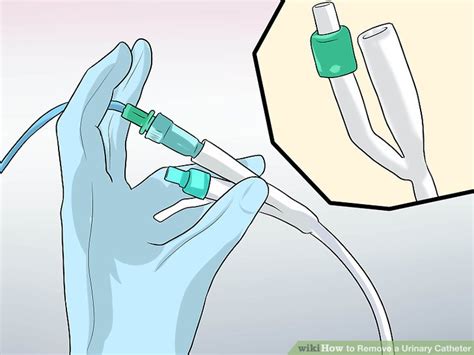 3 Ways To Remove A Urinary Catheter Wikihow