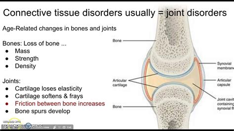 Ask About Vitamins Connective Tissue Disorders Try Serracor Healthy Inflammatory Response