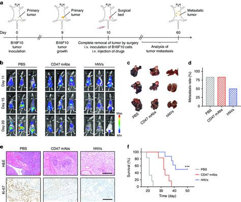 HNVs Inhibit Post Surgery Metastasis Of B16F10 Tumors A Schematic