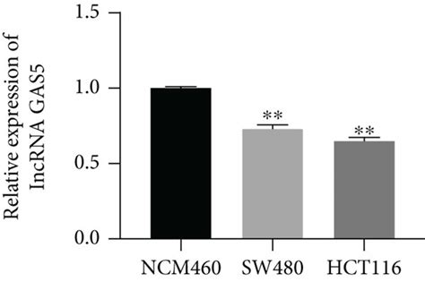 Lncrna Gas5 Acts As A Tumor Suppressor Gene In Colorectal Cancer A