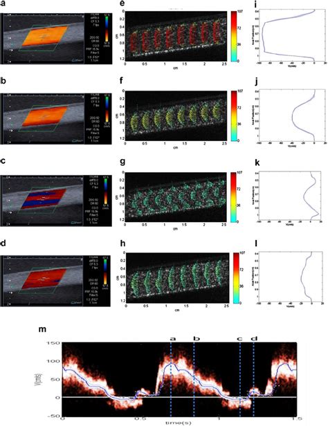 Visualisation And Quantification Of Pulsatile Flow At The Four Phases Download Scientific