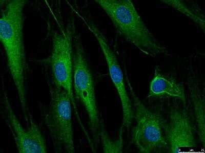 LRRFIP1 Antibody NBP1 71835 Novus Biologicals