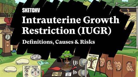 Intrauterine Growth Restriction Iugr Part 1 Of 2 Definitions