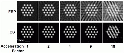 Compressed Sensing Of Spatial Electron Paramagnetic Resonance Imaging