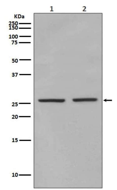 Eif4e P Ser209 Antibody Sr1401 Novus Biologicals 50 μg