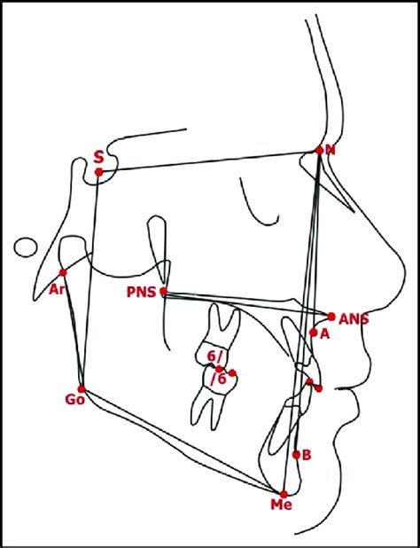 Cephalometric Points Lines And Angles Used In Analysis Sna Snb Download Scientific Diagram