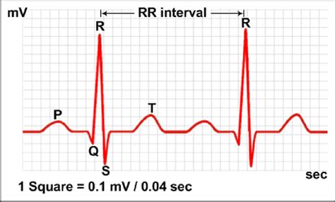 Qrs Labeled