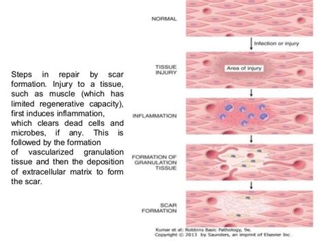 Tissue Repair Regeneration And Wound Healing 1