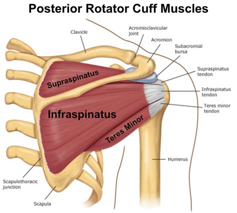 Infraspinatus Syndrome Or Tendinitis Back Care Clinic