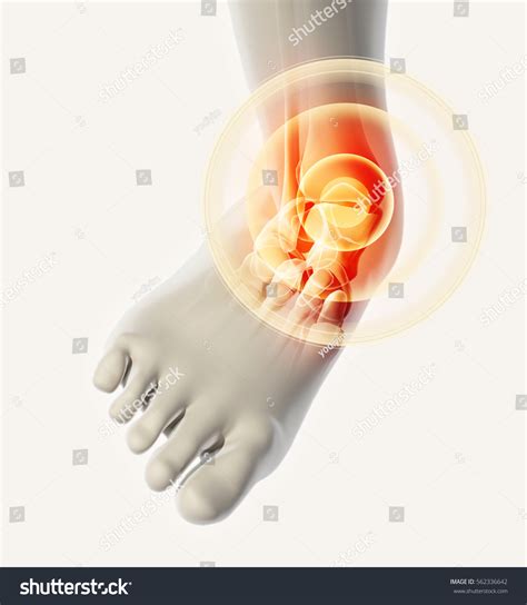Ankle Painful Skeleton X-ray 3d Illustration Stock Illustration