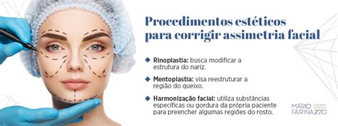 Entenda a relação entre simetria facial e beleza Dr Mário Farinazzo