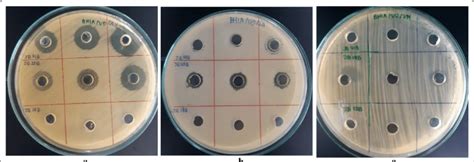 A clear zone of different phyllosphere bacteria, the activity was ...