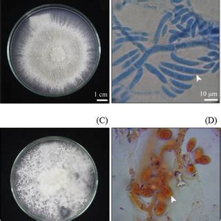 Cultural And Morphological Characteristics Of Mycorrhizal Fungi On Pda