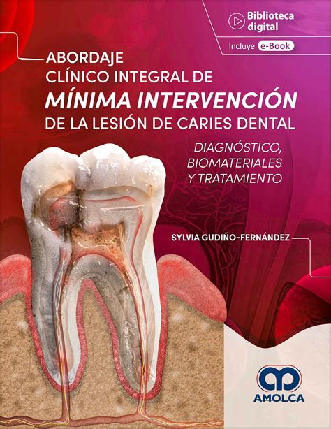 Abordaje Clínico Integral de Mínima Intervención de la Lesión de Caries