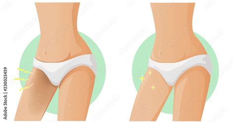 Female Groin Area