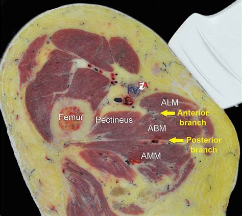 Obturator Foramen Nerve