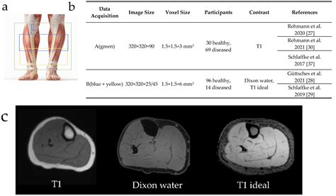 Diagnostics Free Full Text D Automated Segmentation Of Lower Leg