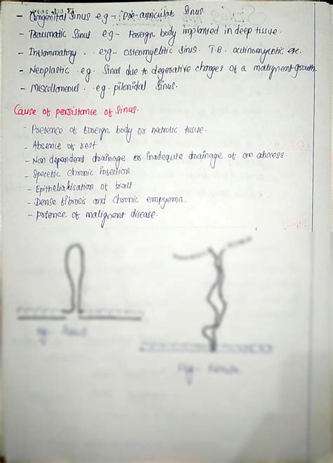 SOLUTION Sinus And Fistula Studypool