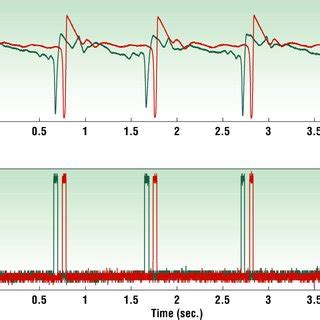 Phonocardiogram Pcg Waveforms We Simultaneously Measured Pcg At A