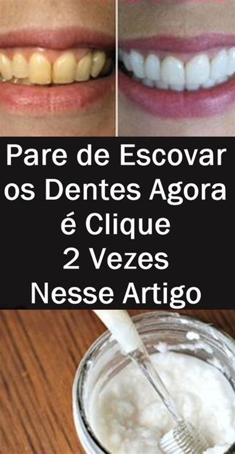 Como Clarear Os Dentes Sem Ir Ao Dentista Passo A Passo Clareamento