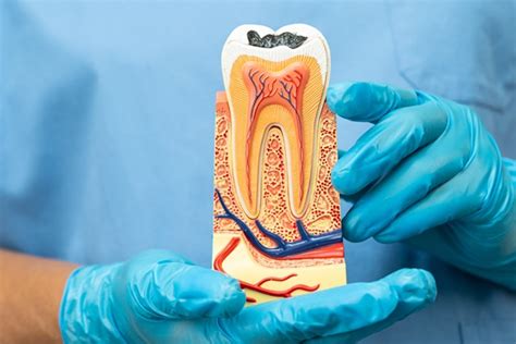 The Root Canal Procedure Explained Step By Step Basti Dental Care