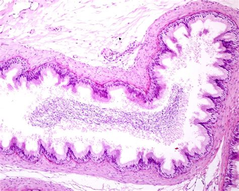 Efferent Ducts Photograph By Jose Calvo Science Photo Library