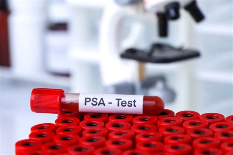 Prostate à partir de quel taux de PSA s inquiéter