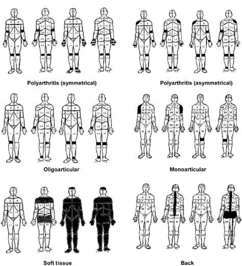 Figure 1 From The Sensitivity And Specificity Of Pain Diagrams In