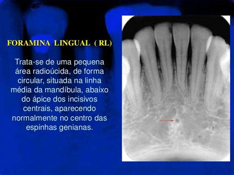 Anatomia Dento Maxilo Mandibular