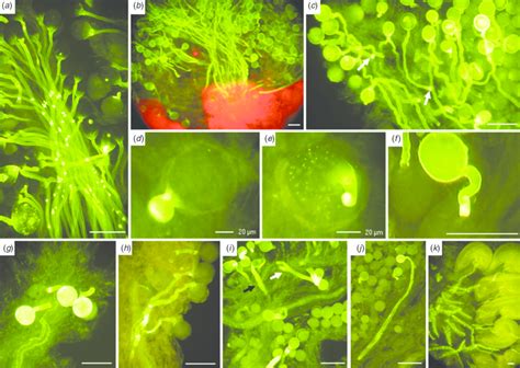 In Vivo Pollen Tube Growth In Pistils 2 Days After Pollination Normal